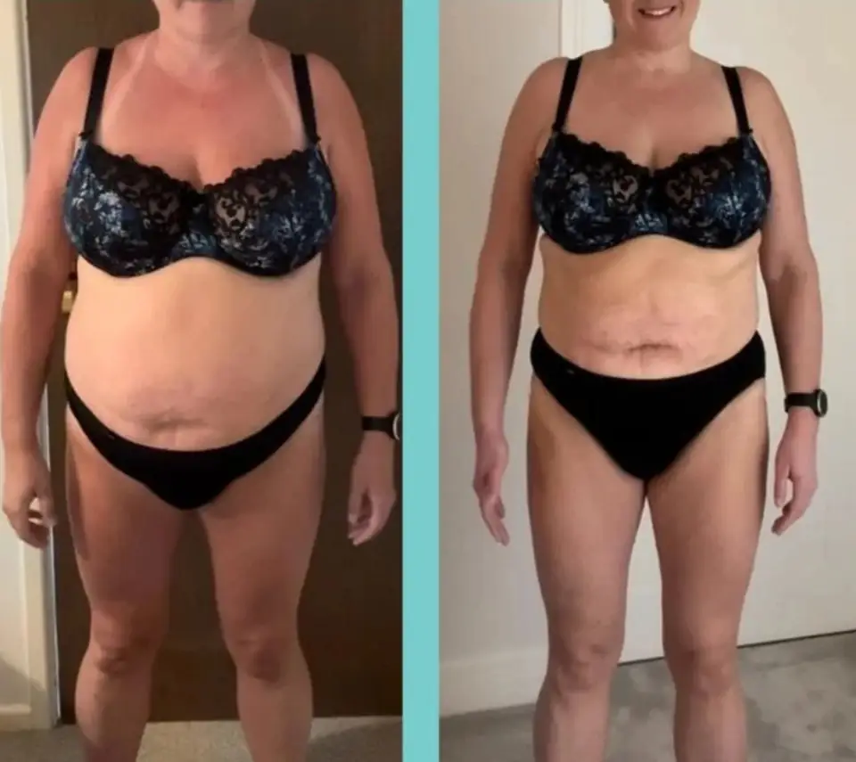 Before and after of a client: both sides show a front view in a black patterned bra and black briefs, standing indoors, the left against a dark door and the right against a pale wall.